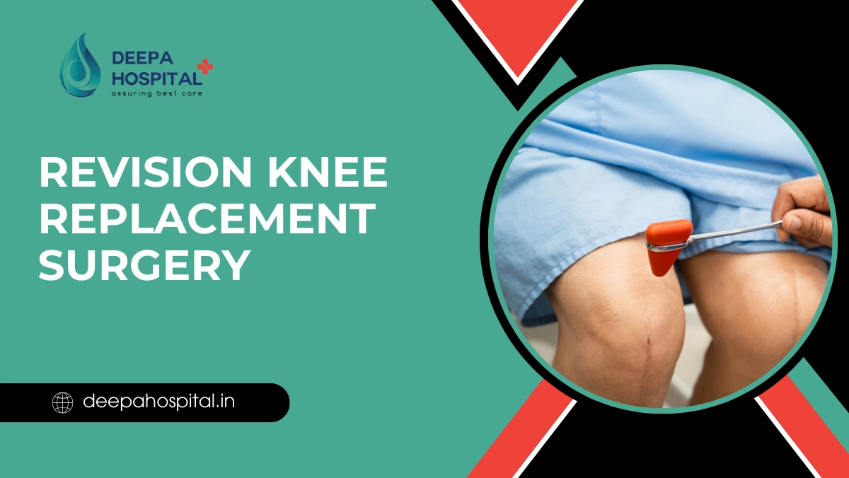 revision knee replacement surgery